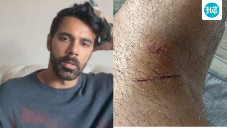 Anuj Sachdeva alleges ‘no arrest’ made after he was attacked over parking dispute, talks about his ‘mental trauma’